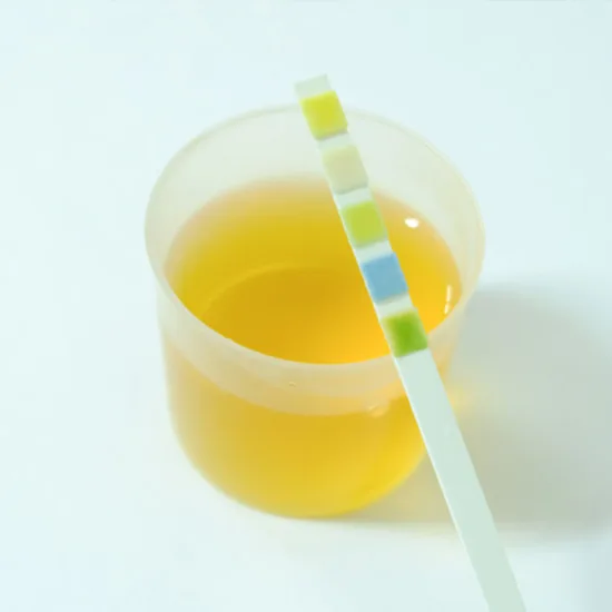 Calcium Creatinine Ratio Random Urine Test